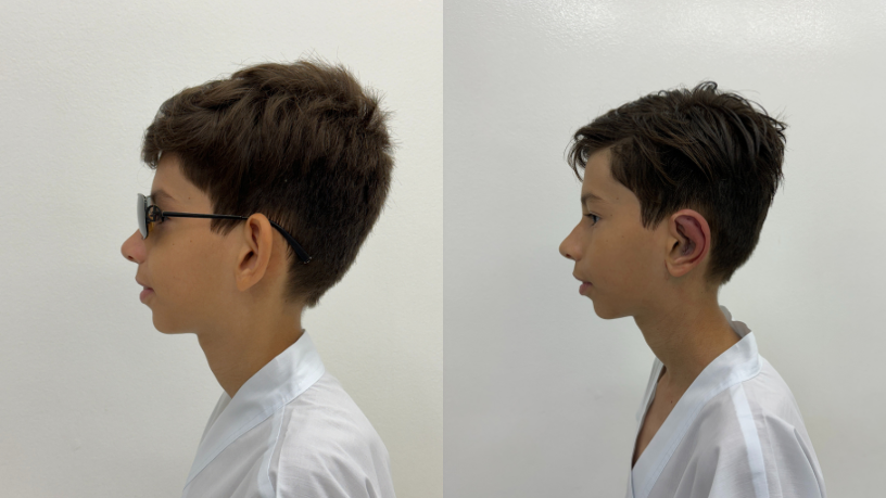 A busca por cirurgias plásticas sutis cresce com a tendência por beleza autêntica e discreta, comenta Milton Seigi Hayashi.